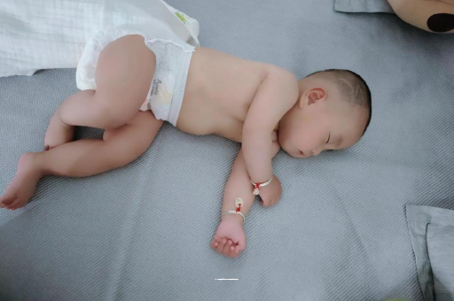 老河口六个月宝宝眼睛散光